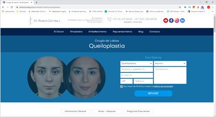 Embellecimiento facial / Queiloplastia, Sitio web HTML5 Dr. Álvaro Correa